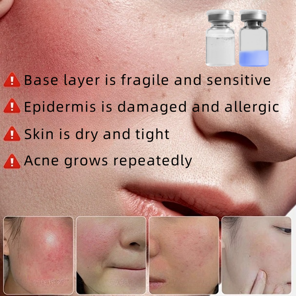 High Purity Tripeptide-1 Copper Peptide Skincare Powder Essence Anti-aging Skin Repair Acne Treatment Freeze-dried Powder Serum