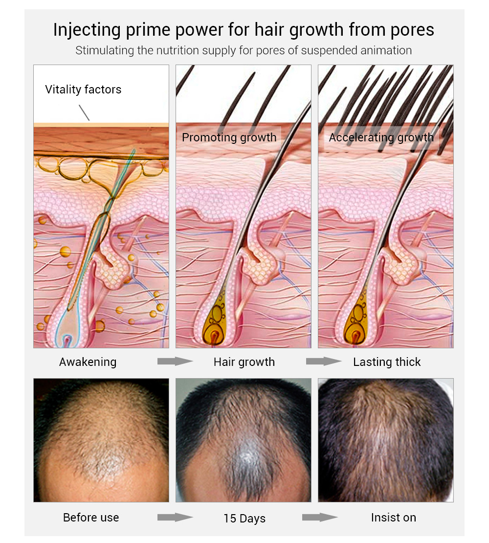 LANBENA Hair Grow Spray Details 3