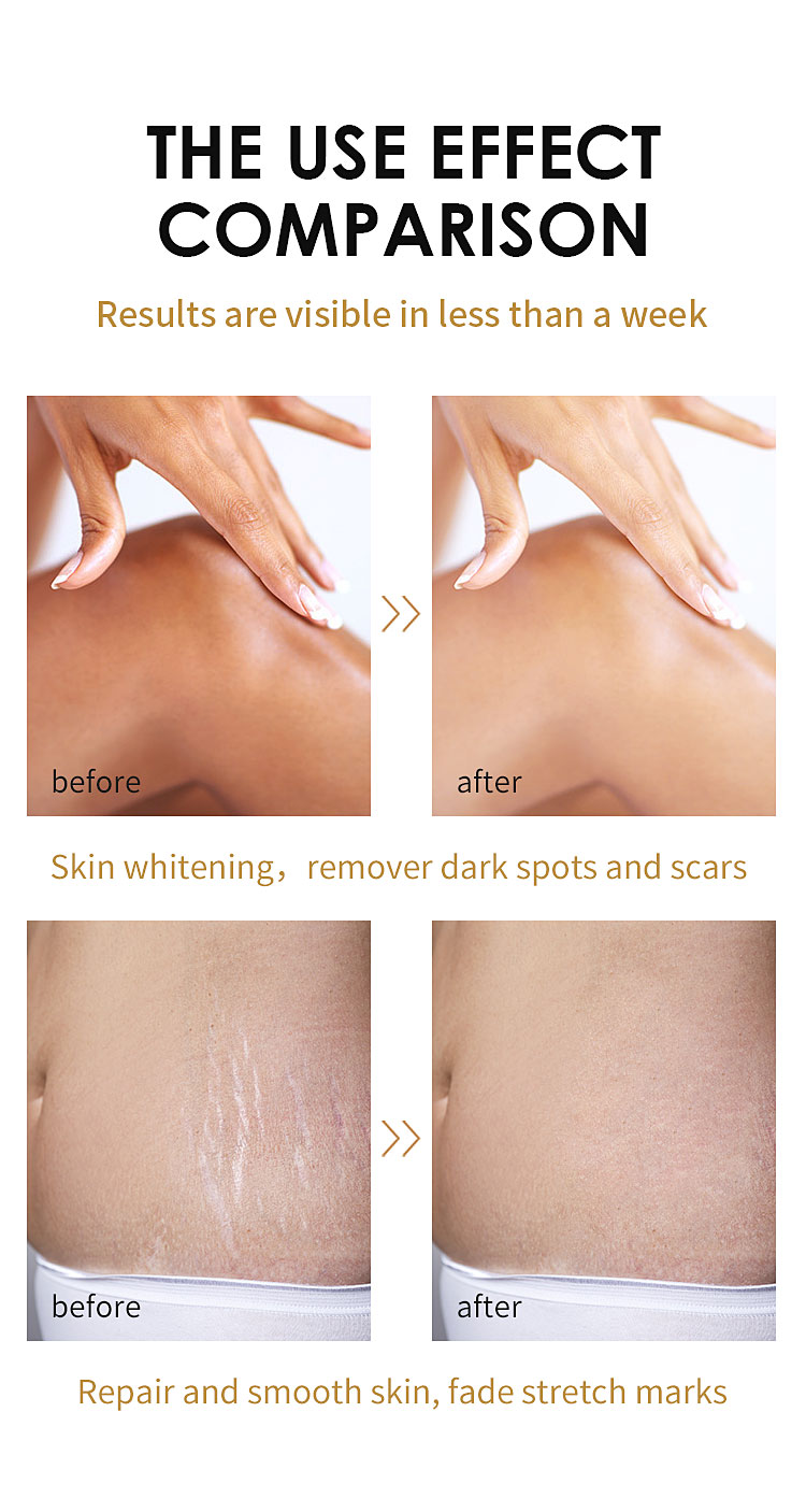 Skin Lightening Oil Details 6