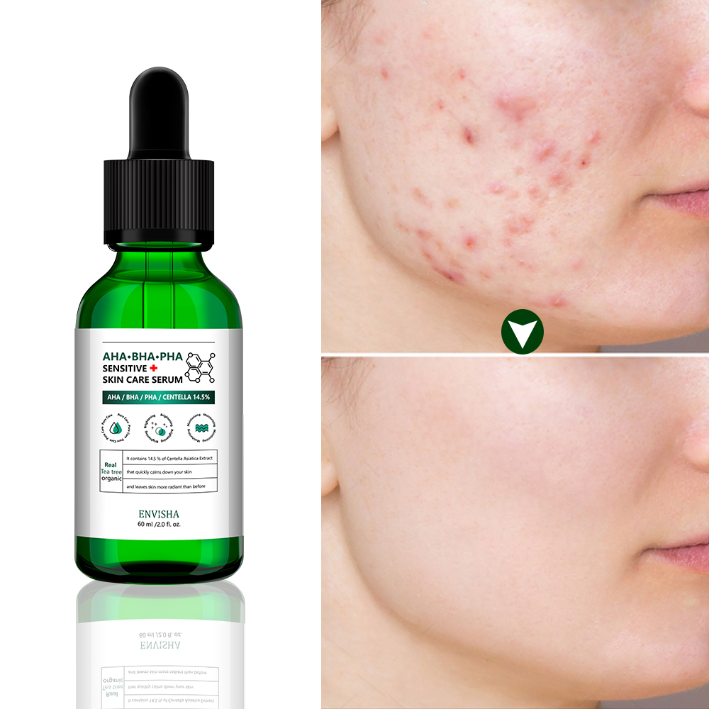 Natural AHA BHA PHA Tea Tree Facial Serum Whitening Exfoliating Acne Face Skin Care Oil Serum
