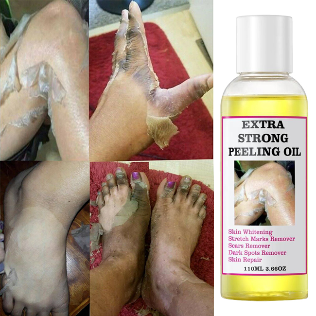 OEM Organic Black Skin Lightening Whitening Peeling Oil Extra Strength Exfoliating Serum For Face Body Private Label 3-Year