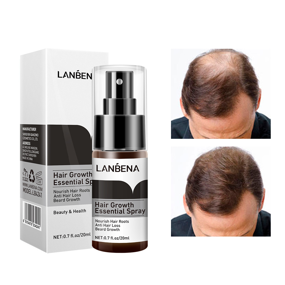 LANBENA Herbal Instant Hair Grow Spray Hair Treatment Growth Women Wholesale