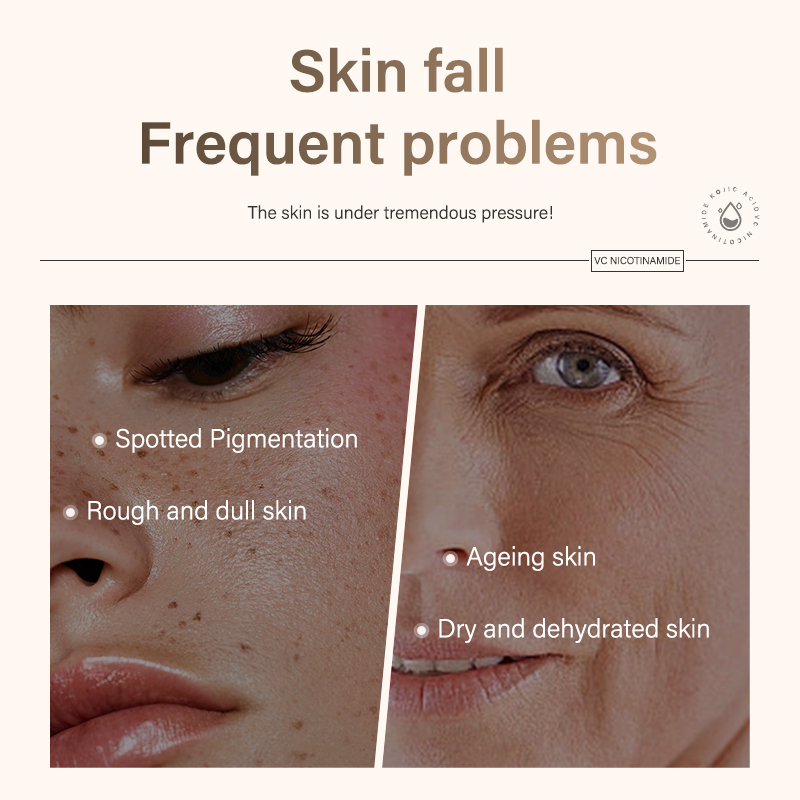 Kojic Acid Serum 30ml Vitamin C Niacinamide Brightening Dark Spot Correcting OEM Private Label