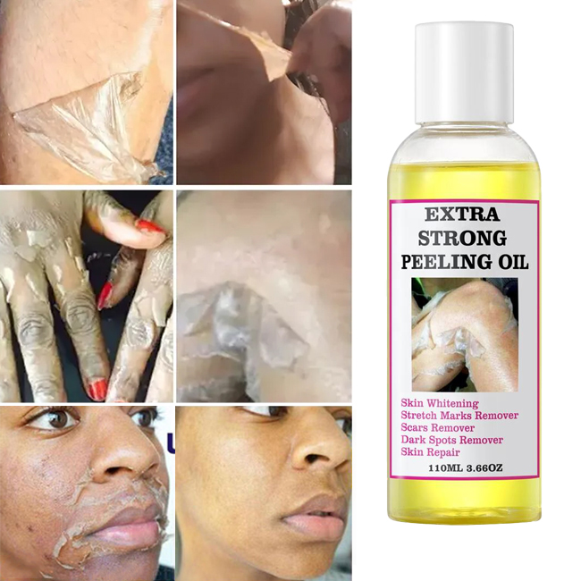 OEM Organic Black Skin Lightening Whitening Peeling Oil Extra Strength Exfoliating Serum For Face Body Private Label 3-Year