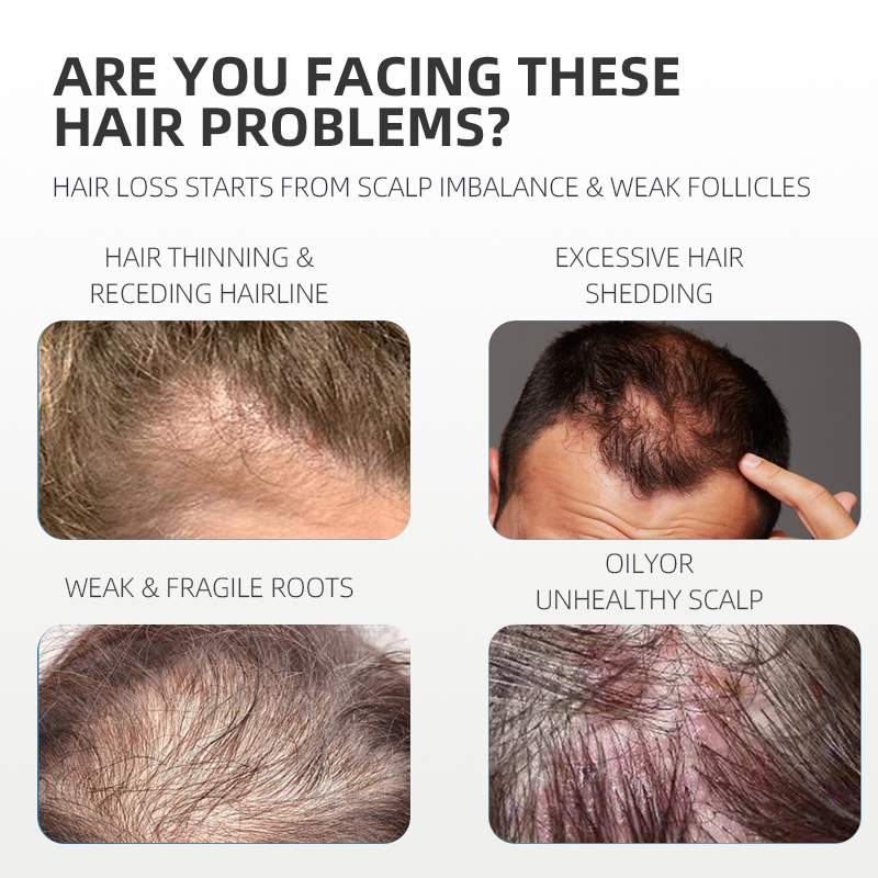Private Label Copper Peptide Strengthening Scalp Care Hair Repair Nourishing Spray GHK-Cu Hair Growth Serum Spray For Women Men