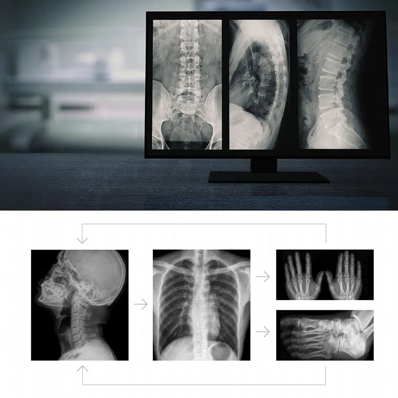 Factory Customized High Frequency Digital X-ray Radiography System for Medical Diagnosis