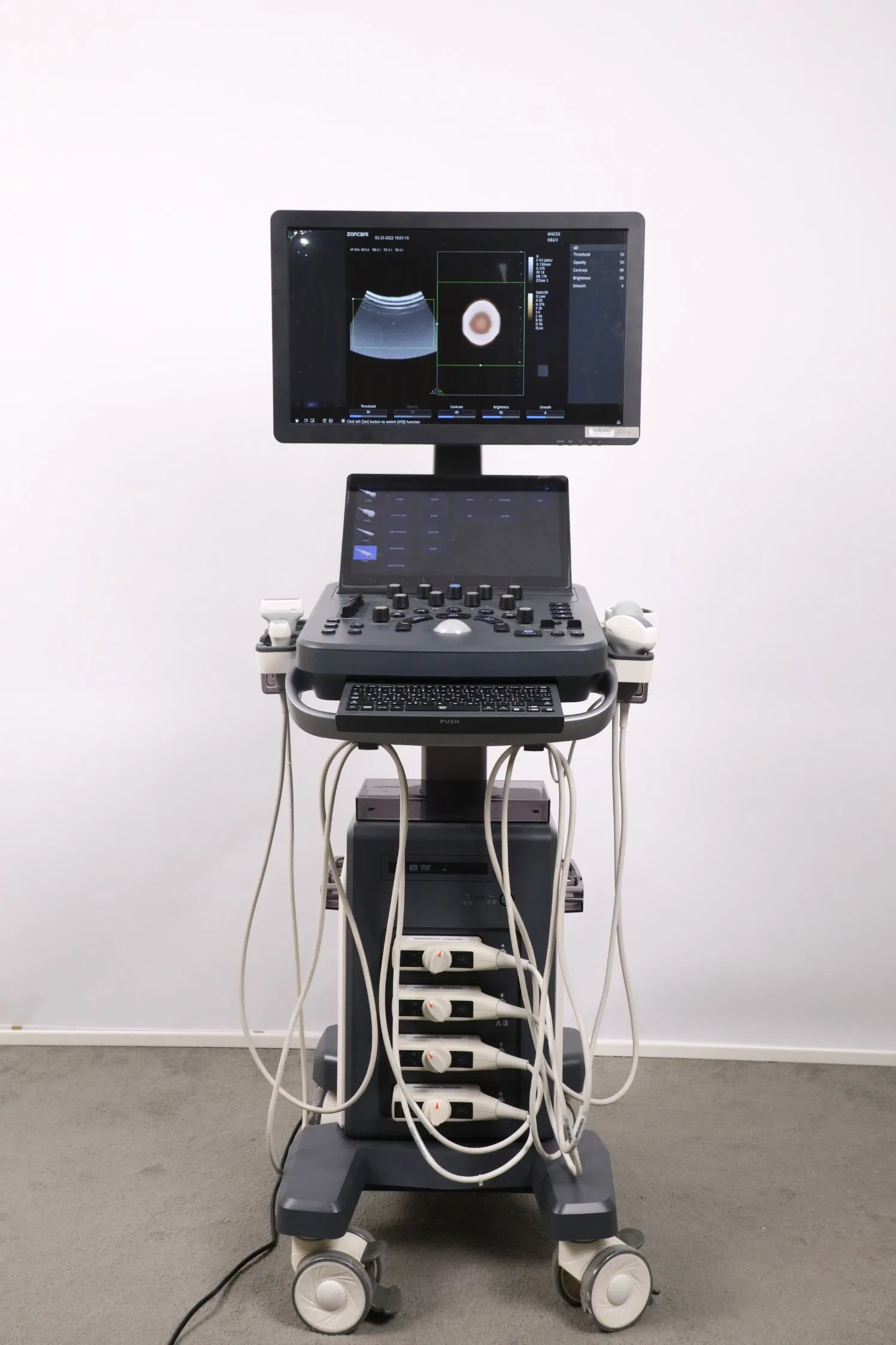 Zoncare ViV20 Full Digital Color Doppler Ultrasonic Diagnostic System