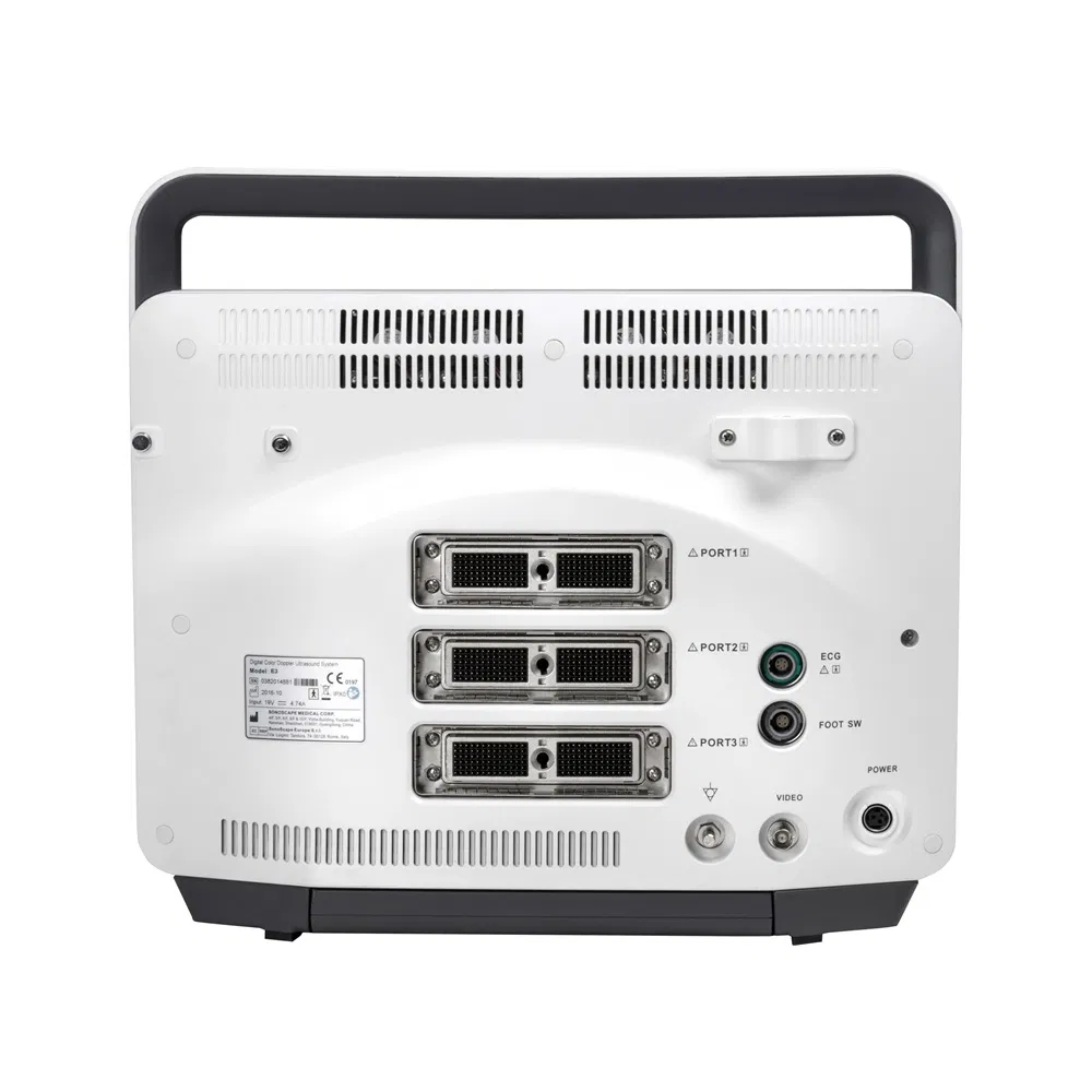 Portable Full Digital Diagnosis Color Doppler Ultrasound System