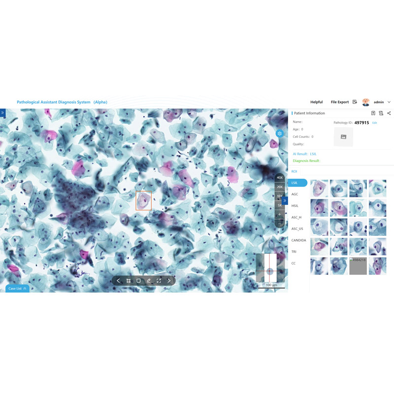 Digital Intelligent Pathology Ai Assisted Diagnosis System