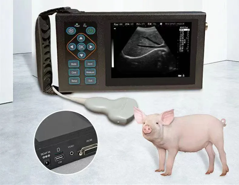 Ultrasound Scanner View 1