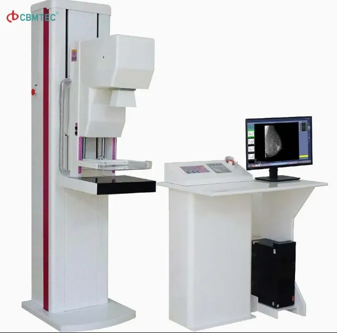 Digital Mammography System 1