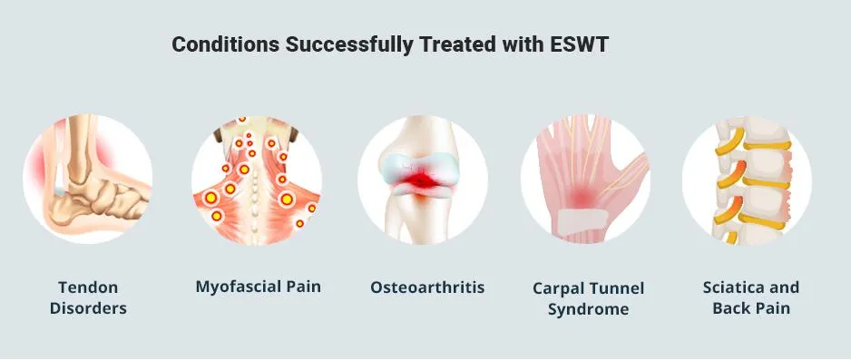 Shockwave Application
