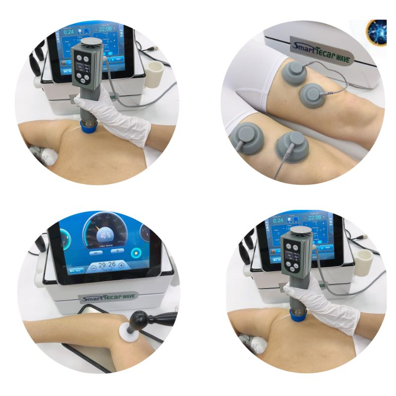Portable 2024 Tecar Ret Cet RF Physiotherapy Tecar Therapy Hyperthermia Body Care 448 kHz Rehabilitation Therapy Home Device