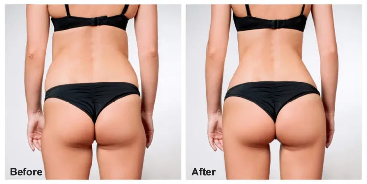 Device Application 2