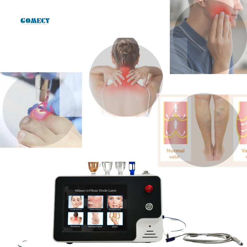 60W 100W Class 4 Medical Diode Laser Therapy Systems Best for Sports Injuries 810/980 Nm Pain Relief