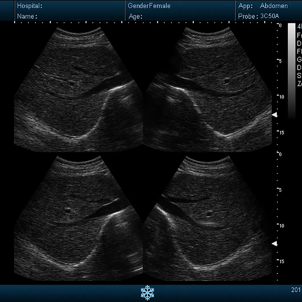 Doppler Diagnosis System 1