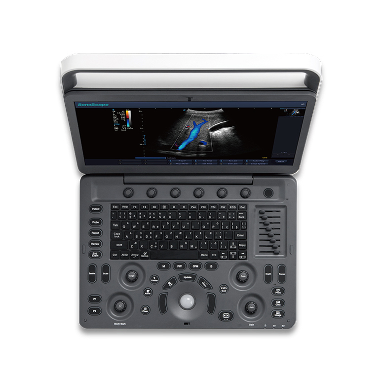 Portable Full Digital Diagnosis Color Doppler Ultrasound System