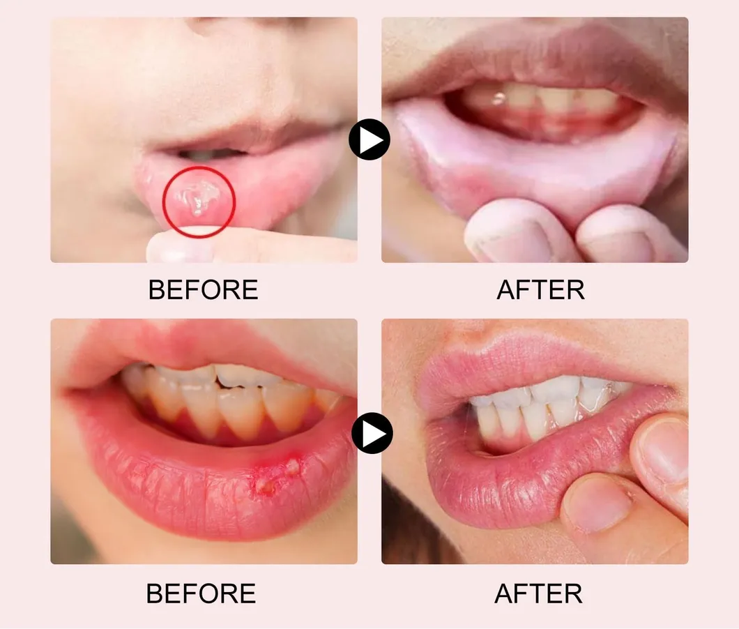 Therapy Device Detail 1