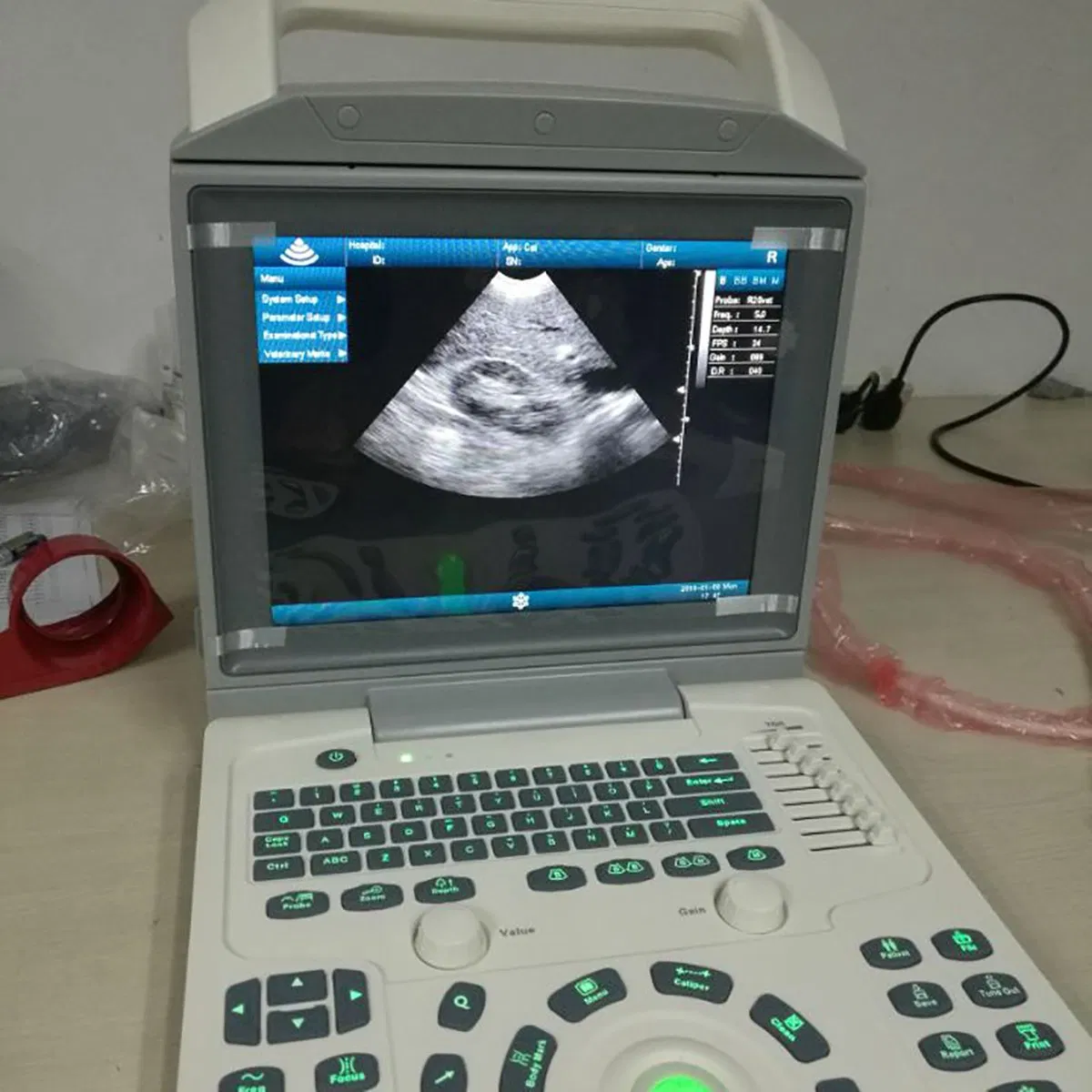 Full Digital Laptop Doppler Diagnosis System