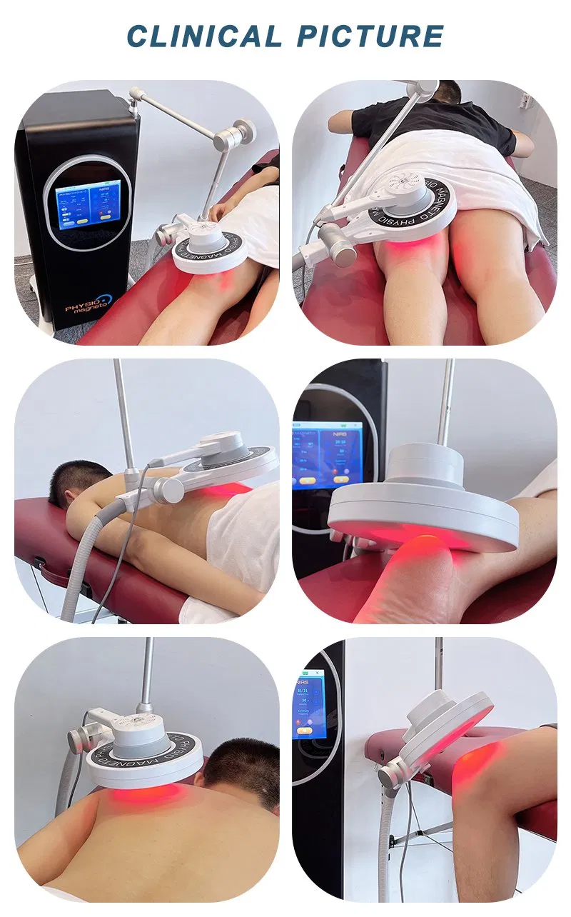 Portable Extracorporeal Magneto Therapy High Frequency Physiotherapy Magnetfeld Therapy Magnetic Therapy Device