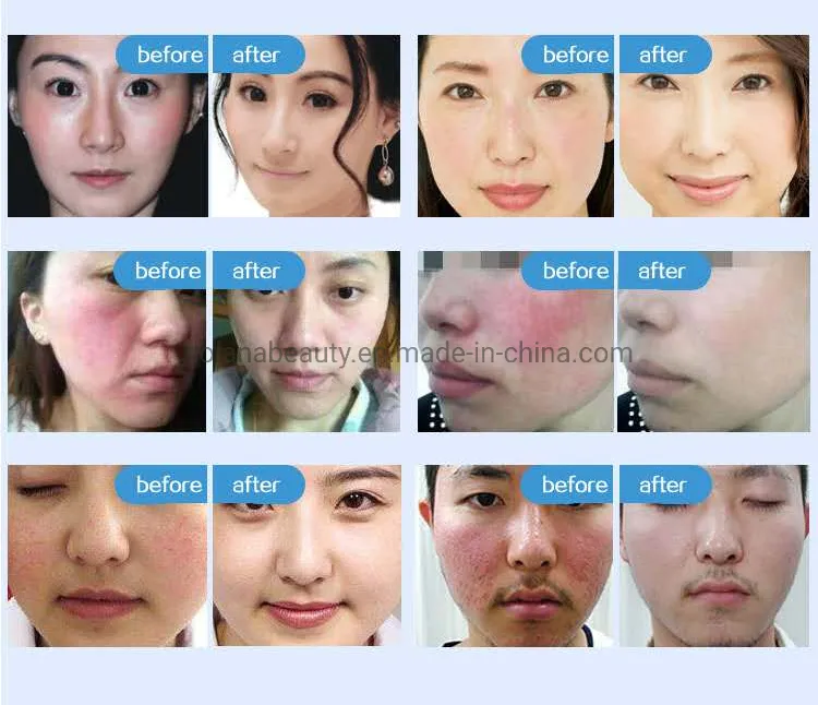 Before and After Results