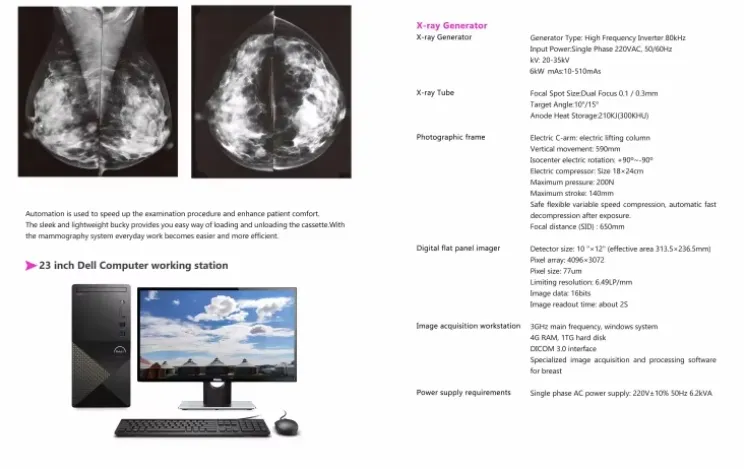 Digital Mammography System 7