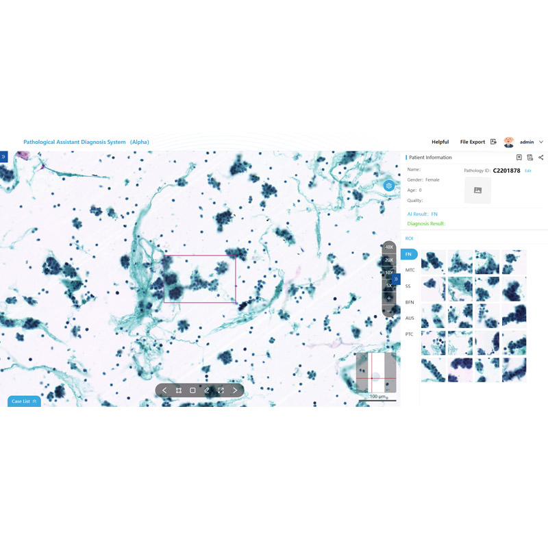 Digital Intelligent Pathology Ai Assisted Diagnosis System