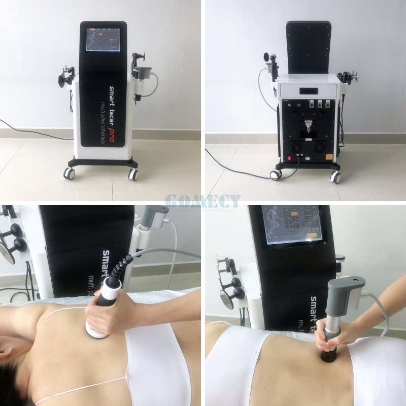 Portable 3 in 1 Tecar Ultrasound Shockwave Physiotherapy Device for Modern Wellness