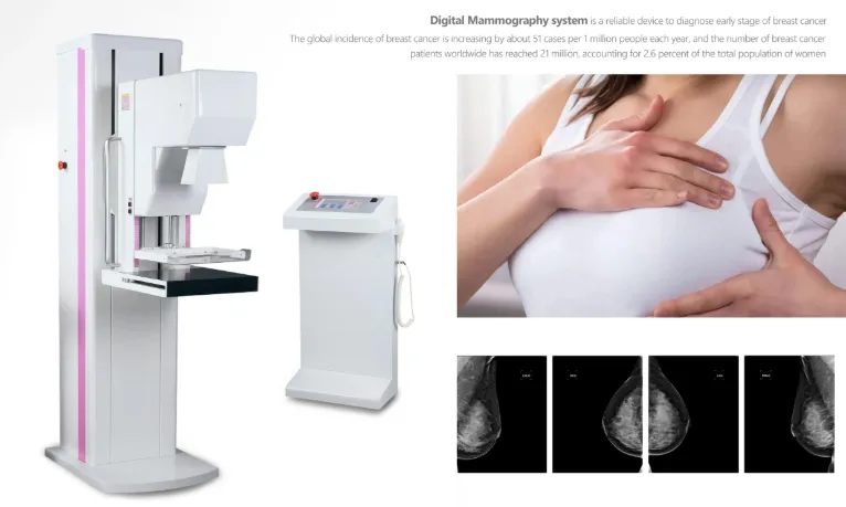 Digital Mammography System 5