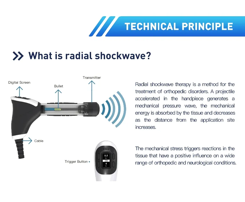 Shockwave Therapy Detail