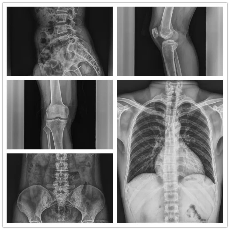 Factory Customized High Frequency Digital X-ray Radiography System for Medical Diagnosis