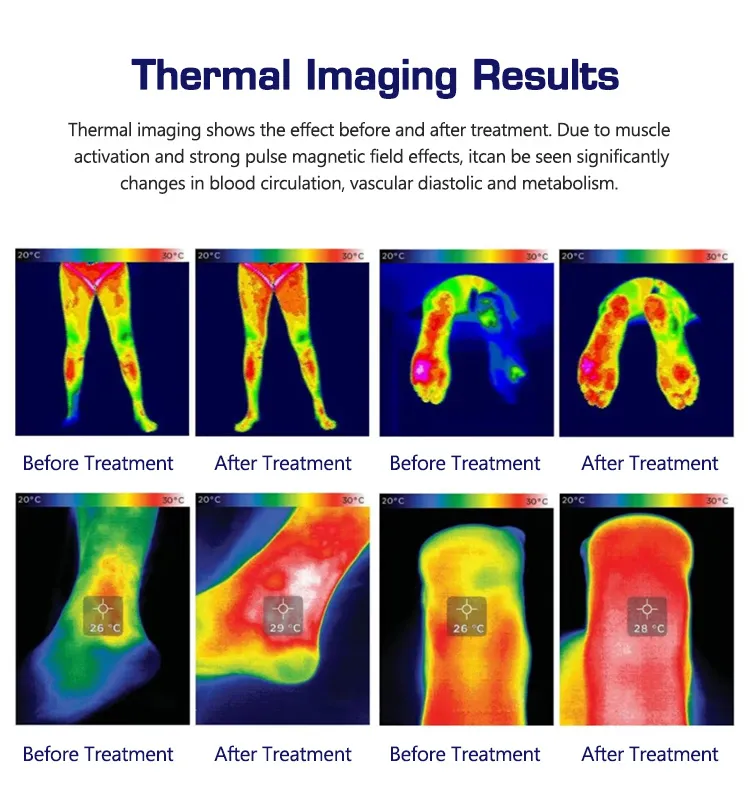 Magneto Therapy Device 6