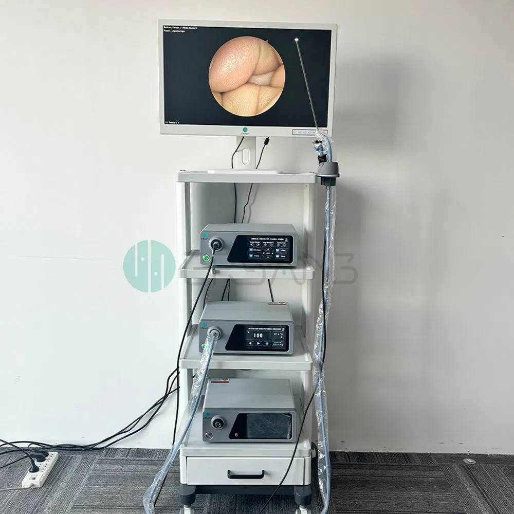 New Cheap 4K UHD Endoscopy Camera System for Ent Arthroscopy Spine Laparoscopy Urology Gynecology