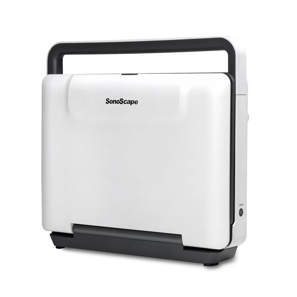 Portable Full Digital Diagnosis Color Doppler Ultrasound System