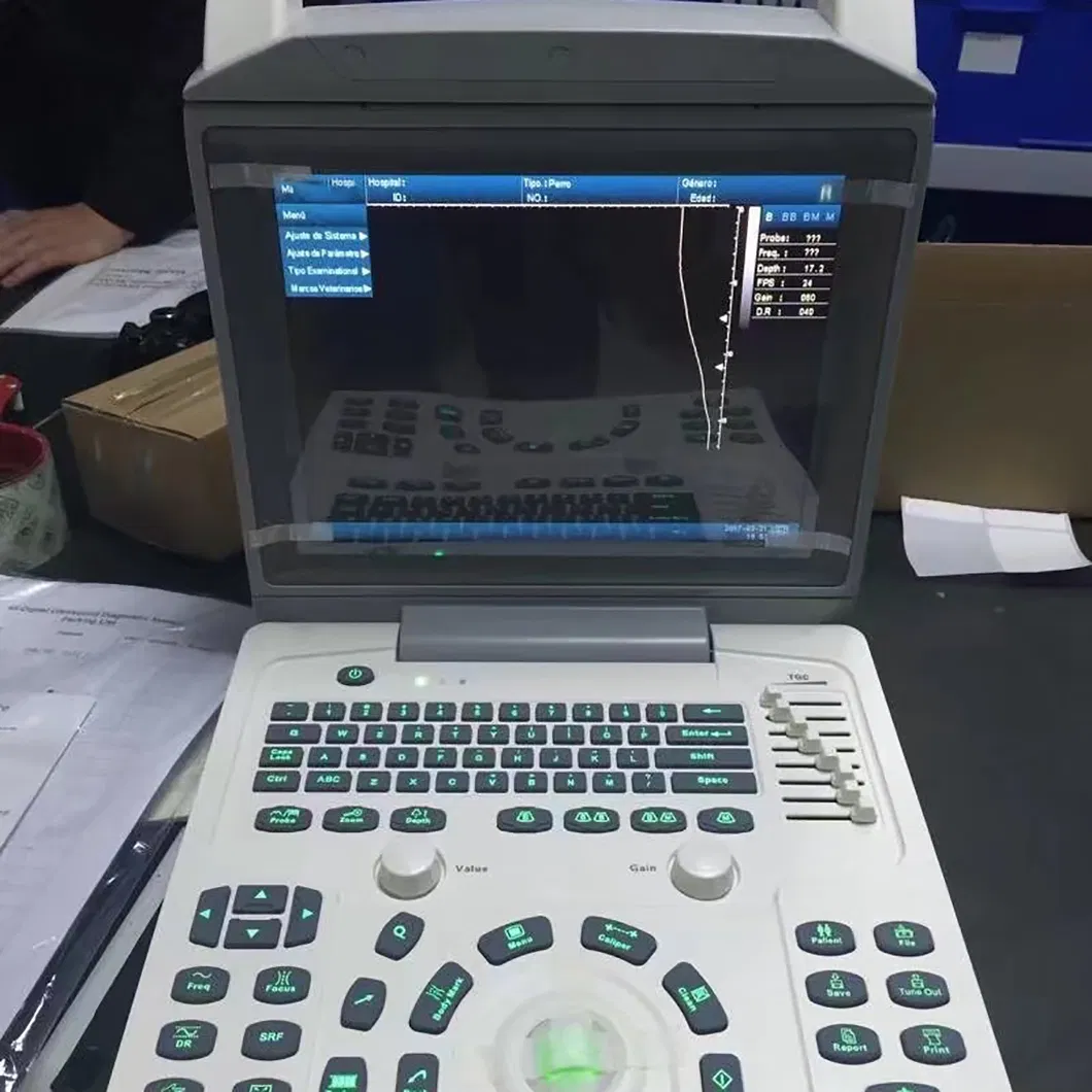 Doppler Diagnosis System 4