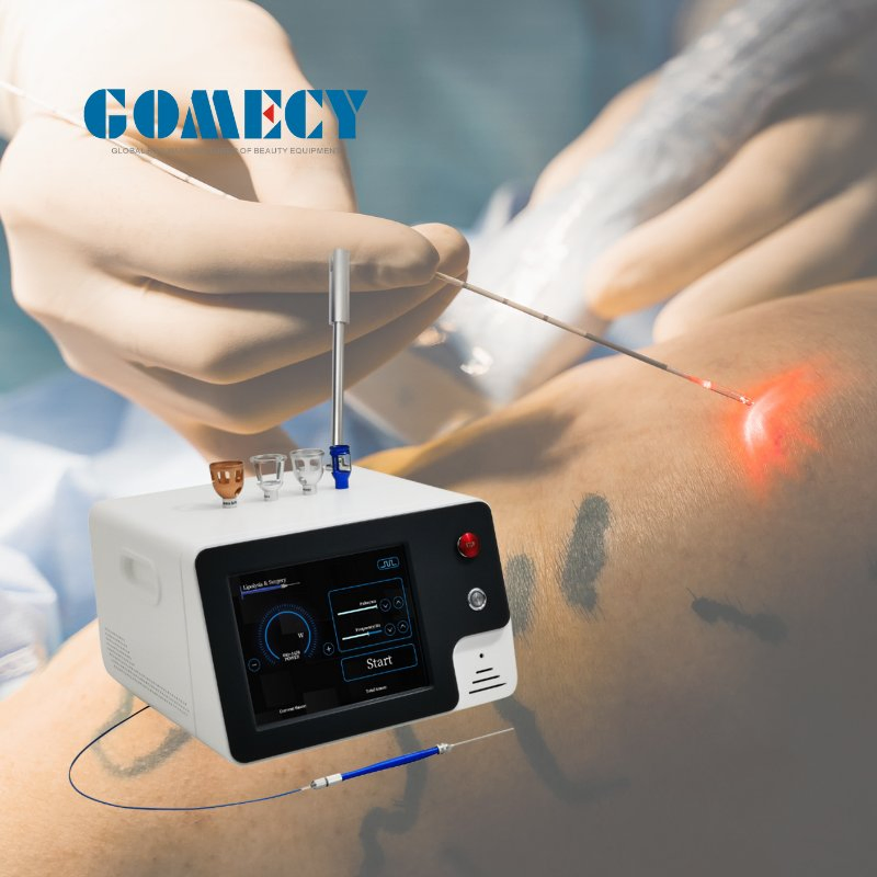 60W 100W Class 4 Medical Diode Laser Therapy Systems Best for Sports Injuries 810/980 Nm Pain Relief