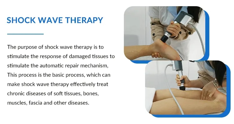 3 Handles Eswt Pneumatic Ultrasonic Wave Physiotherapy RF Cellulite Shockwaves Therapy Machine