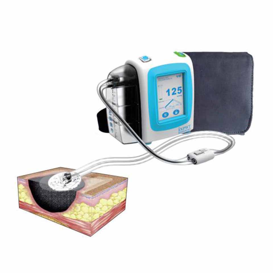 Devices Equipment Negative Pressure Wound Therapy System Machine Negative