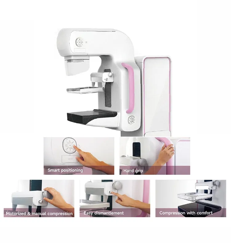 Digital Mammography Machine View 2