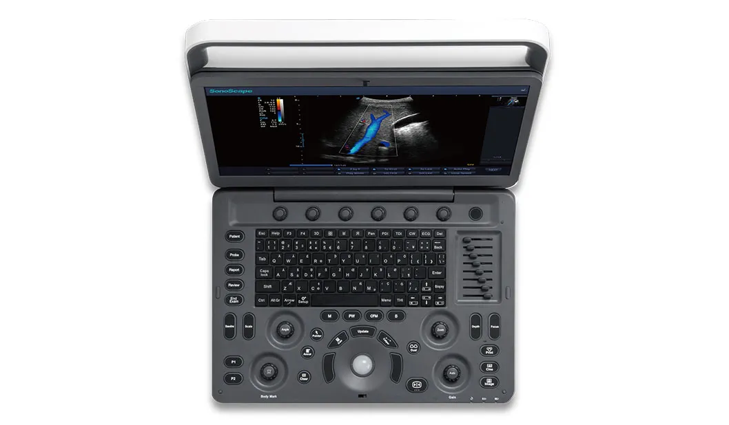 E2 Portable Ultrasound