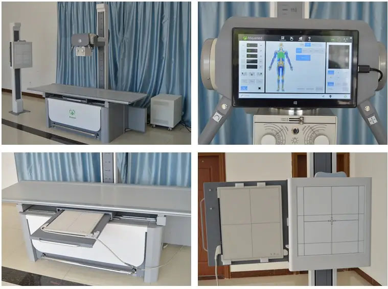 Factory Customized High Frequency Digital X-ray Radiography System for Medical Diagnosis