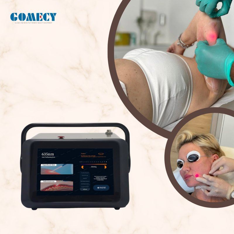 Nail Fungus Removal Laser Prismalift for Onychomycosis Treatment and Eczema Herpes Therapy