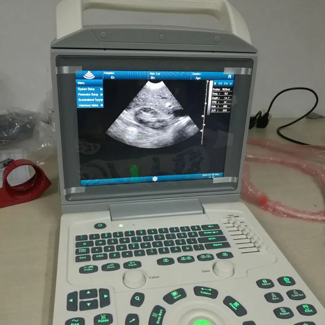 Doppler Diagnosis System 3