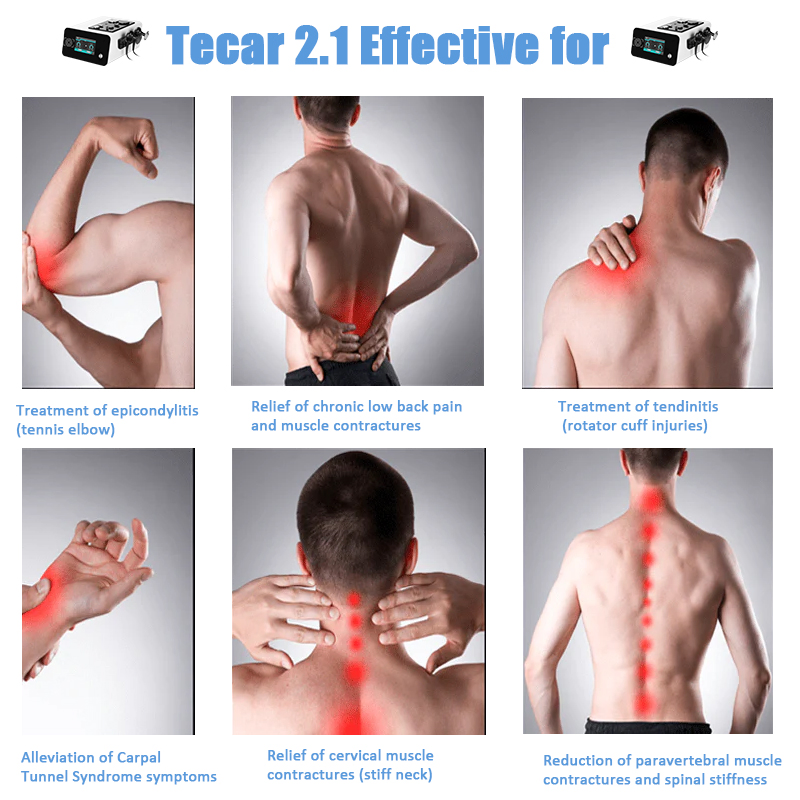 Tecar PRO Max 448kHz Physiotherapy Device Portable Tecar for Professional Pain Management