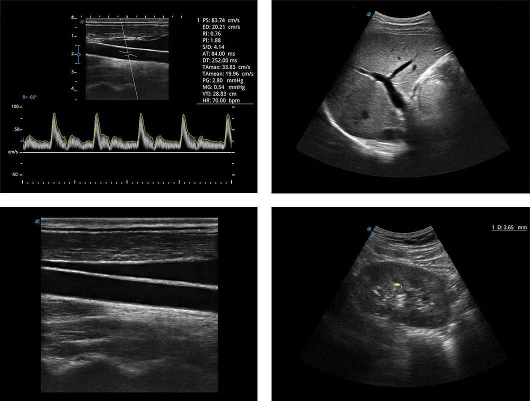 Ultrasound Image Sample