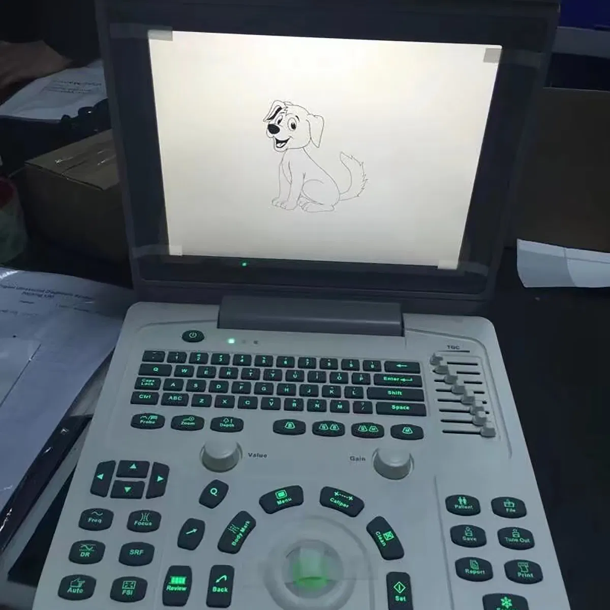 Full Digital Laptop Doppler Diagnosis System