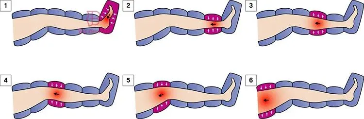 Infrared Compression