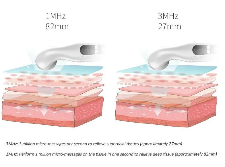 Portable Handheld Ultrasound Therapy/Physiotherapy Pain-Relieving Massager Device Pw-5X