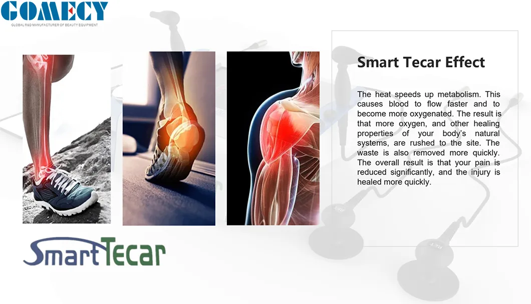 Smart Tecar Effect