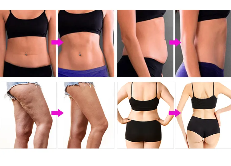 Before and After Results